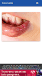 Mobile Screenshot of estomatitis.com